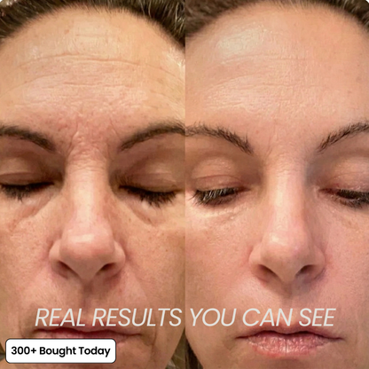Last Day Buy 1 Get 1 Free Collagen Plump & Repair Balm