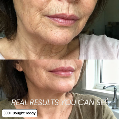 Last Day Buy 1 Get 1 Free Collagen Plump & Repair Balm